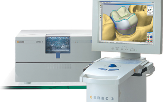 Cerec® CAD-CAM-Zahnersatz